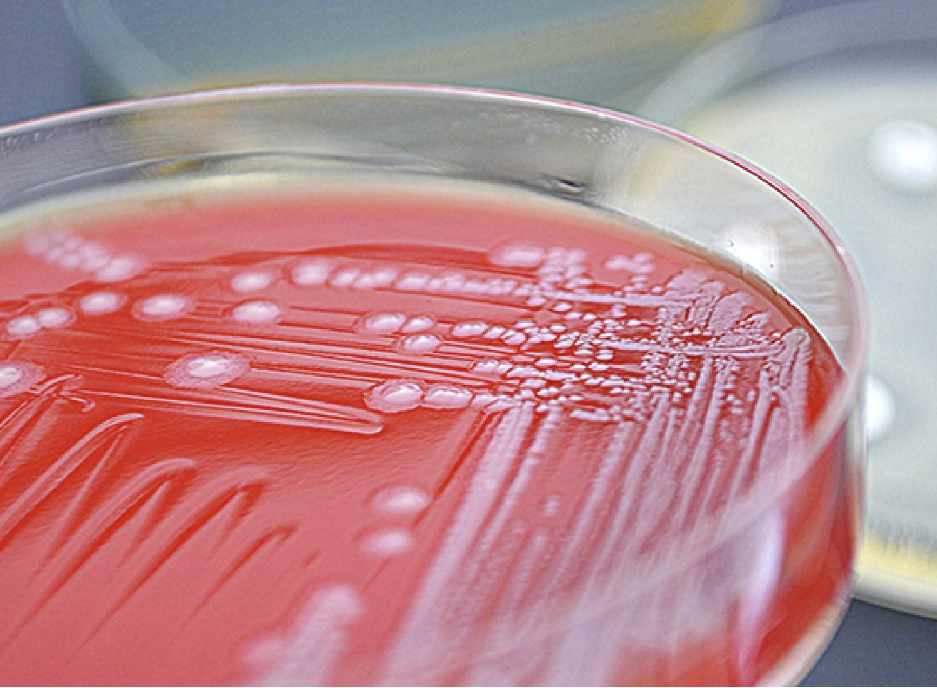 Petri dish
